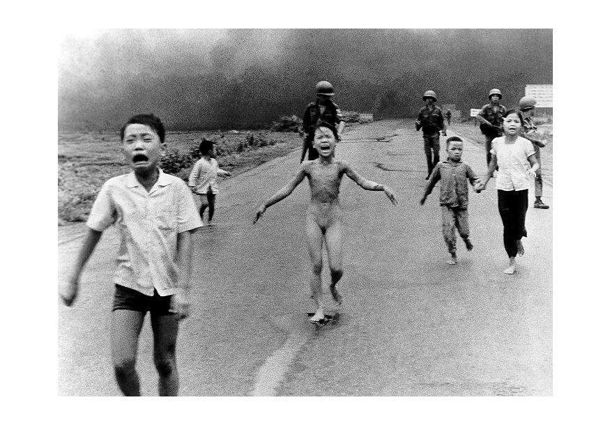 Photo enfants aprA¨s une attaque au napalm